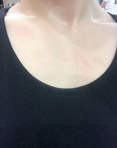 欧美不明儿童肝炎病例_全集神马影院